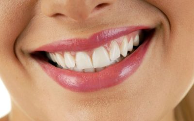 Considering a smile makeover? Look for a good cosmetic dentist